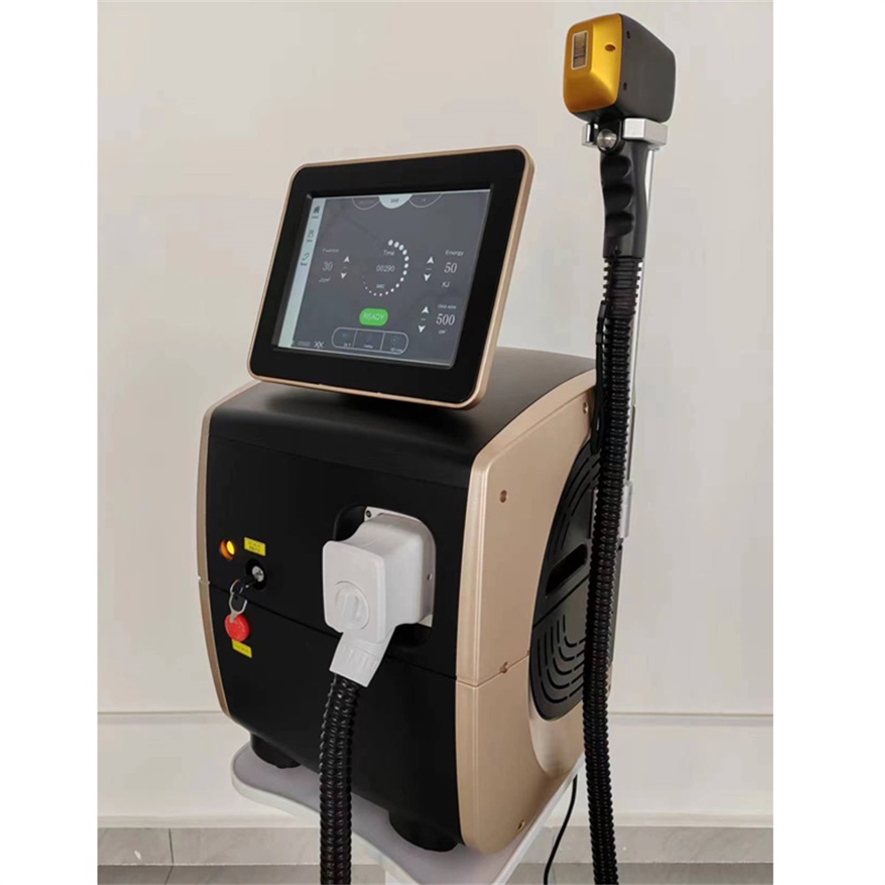 Epilatore Laser a Diodo ad Alt - Industrial Laser Cleaning Machine recensione e prezzo